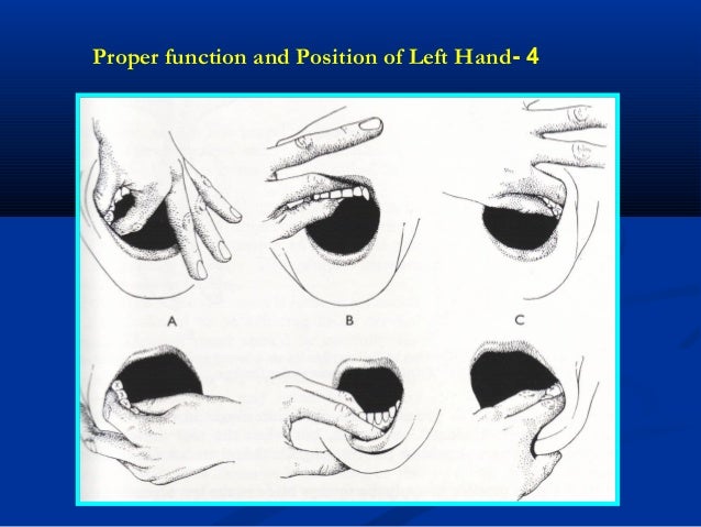 at 5 once extractions elevator Rules forceps of using dental &