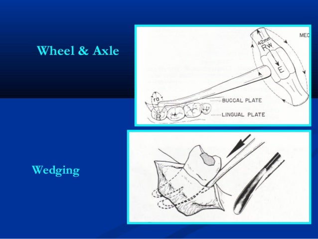 rules-of-using-dental-forceps-elevator-6