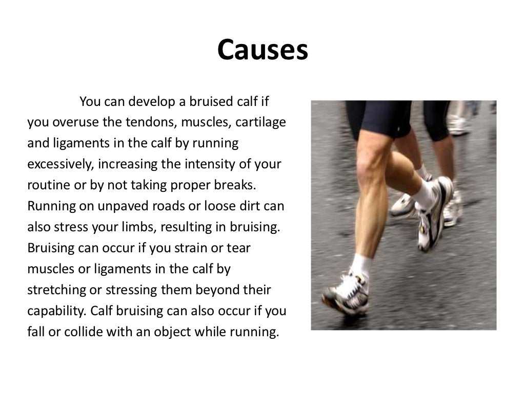 Running bruised calf