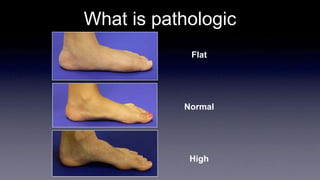 What is pathologic
Flat
Normal
High
 