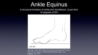 Ankle Equinus
A structural limitation of ankle joint dorsiflexion. (Less then
10 degrees of DF)
Root ML, Orien WP, Weed JH. Normal and Abnormal Function
of the Foot -Volume 2. Clinical Biomechanics Corp., Los
Angeles, CA, 1977.
 