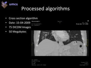 Running Dicom Visualization On The Cell (Ps3) Rsna Poster Presentation ...