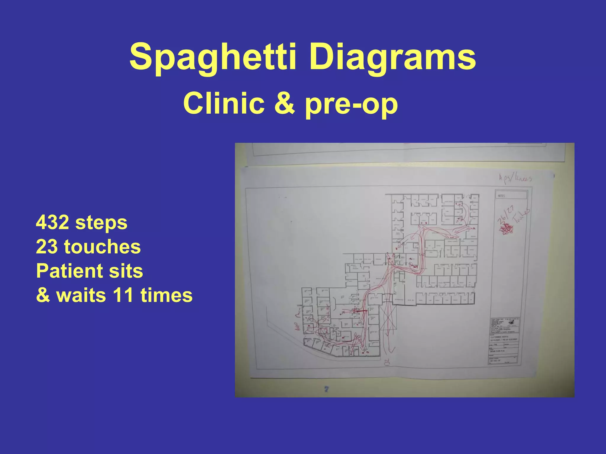 Spaghetti Diagrams
Clinic & pre-op
432 steps
23 touches
Patient sits
& waits 11 times
 