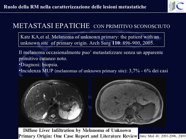 Sodani Giulio Ruolo Della Rm Nella Caratterizzazione Delle