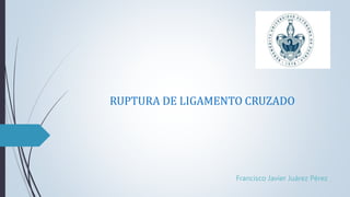 RUPTURA DE LIGAMENTO CRUZADO
Francisco Javier Juárez Pérez
 