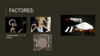 FACTORES:
TABAQUISMO > 2 -4
VECES
 