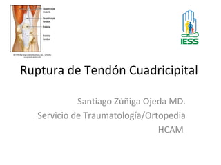 Ruptura de Tendón Cuadricipital

             Santiago Zúñiga Ojeda MD.
   Servicio de Traumatología/Ortopedia
                                HCAM
 