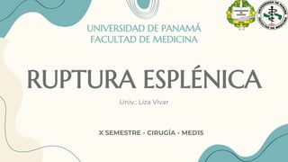 RUPTURA ESPLÉNICA
Univ.: Liza Vivar
X SEMESTRE - CIRUGÍA - MED15
UNIVERSIDAD DE PANAMÁ
FACULTAD DE MEDICINA
 