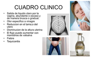 CUADRO CLINICO
• Salida de liquido claro por la
vagina, abundante o escaso y
de manera brusca o gradual.
• Olor especifico a vinagre
• Reduccion en el tama;o del
utero
• Disminucion de la altura uterina
• El flujo puedo aumentar con
maniobras de valsalva
• Fiebre
• Taquicardia
 