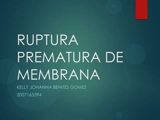 RUPTURA
PREMATURA DE
MEMBRANA
KELLY JOHANNA BENITES GOMEZ
2007165394
 