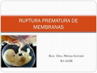 Res: Dra. Mirna Serrate
R1-GOB
RUPTURA PREMATURA DE
MEMBRANAS
 