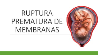 RUPTURA
PREMATURA DE
MEMBRANAS
 