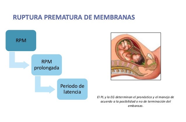 Ruptura prematura de membranas