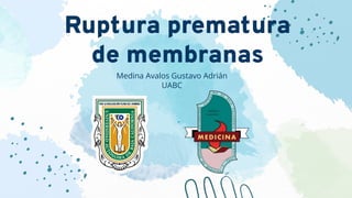 Ruptura prematura
de membranas
Medina Avalos Gustavo Adrián
UABC
 