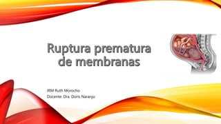 IRM Ruth Morocho
Docente: Dra. Doris Naranjo
 