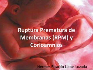 Ruptura Prematura de
Membranas (RPM) y
Corioamnios
Hermes Ricardo Llatas Lozada
 