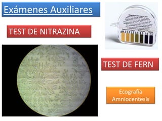 Exámenes Auxiliares
 TEST DE NITRAZINA


                      TEST DE FERN

                          Ecografía
                        Amniocentesis
 