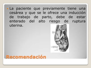 Recomendación
 La paciente que previamente tiene una
cesárea y que se le ofrece una inducción
de trabajo de parto, debe de estar
enterado del alto riesgo de ruptura
uterina.
 