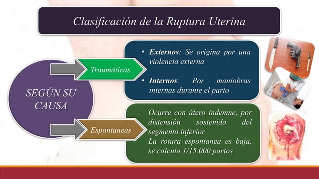 Ruptura uterina y ruptura de vasa previa