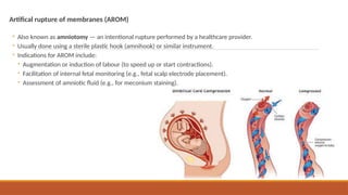 Comprehensive Overview of Rupture of Membranes and Perineal Lacerations ...