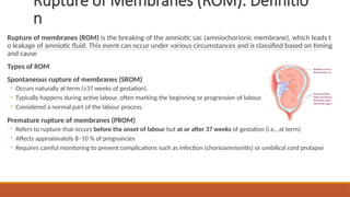 Comprehensive Overview of Rupture of Membranes and Perineal Lacerations ...