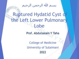 ‫الرحيم‬ ‫الرحمن‬ ‫هللا‬ ‫بسم‬
Ruptured Hydatid Cyst of
the Left Lower Pulmonary
Lobe
Prof. Abdulsalam Y Taha
College of Medicine
University of Sulaimani
2022 1
 