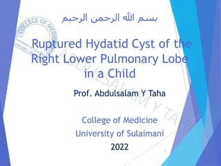‫الرحيم‬ ‫الرحمن‬ ‫هللا‬ ‫بسم‬
Ruptured Hydatid Cyst of the
Right Lower Pulmonary Lobe
in a Child
Prof. Abdulsalam Y Taha
College of Medicine
University of Sulaimani
2022 1
 