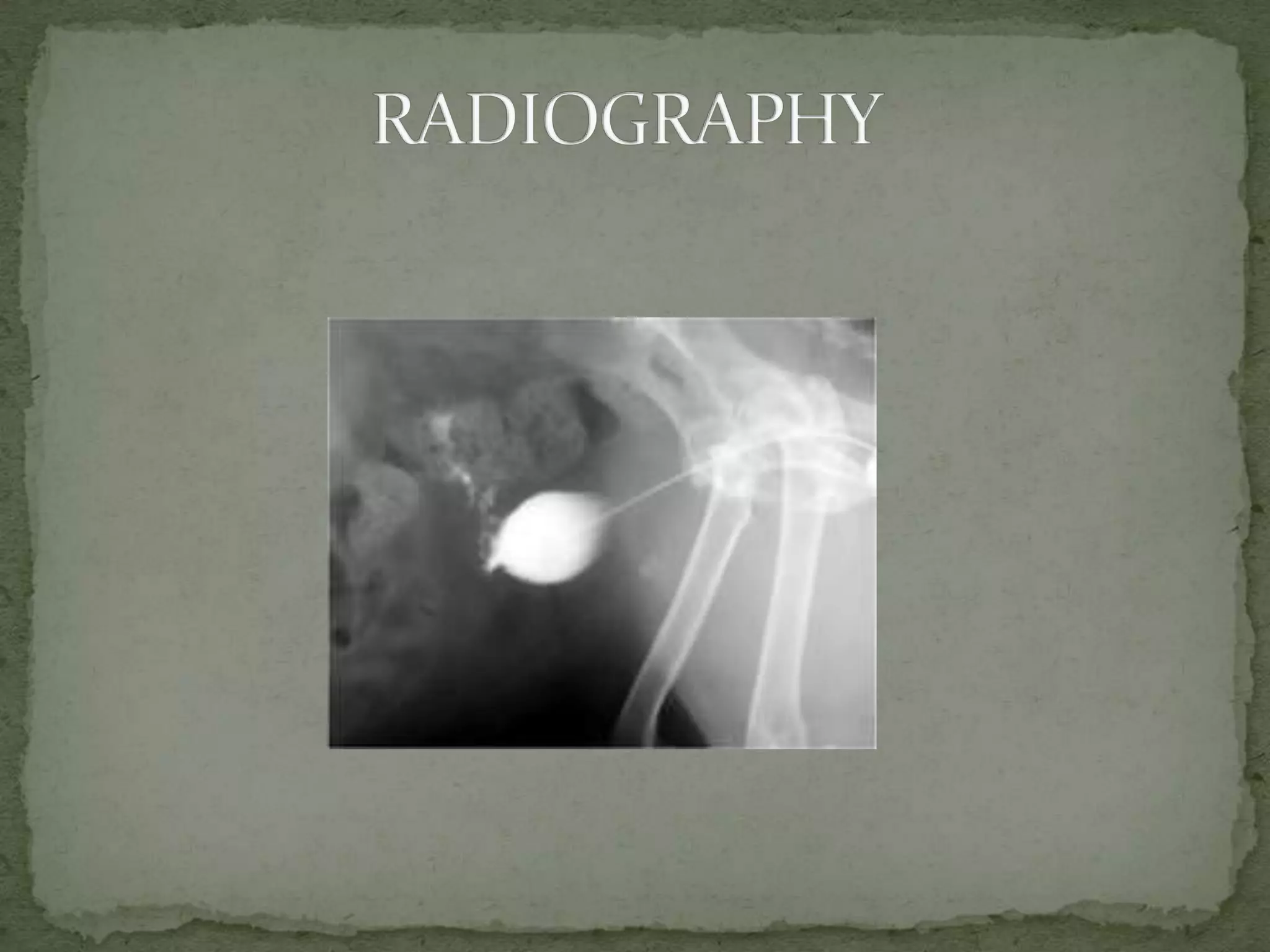 Rupture of urinary bladder in large animals copy (2) | PPTX | Digestive ...