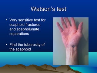 Rural fracture care | PPT