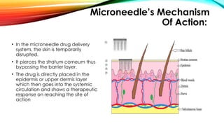 Microneedle in Transdermal Drug Delivery System | PPTX