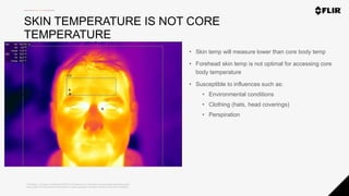 Proprietary - Company Confidential ©2020 FLIR Systems Inc. Information and equipment described herein
may require US Government authorization for export purposes. Diversion contrary to US law is prohibited.
SKIN TEMPERATURE IS NOT CORE
TEMPERATURE
• Skin temp will measure lower than core body temp
• Forehead skin temp is not optimal for accessing core
body temperature
• Susceptible to influences such as:
• Environmental conditions
• Clothing (hats, head coverings)
• Perspiration
 