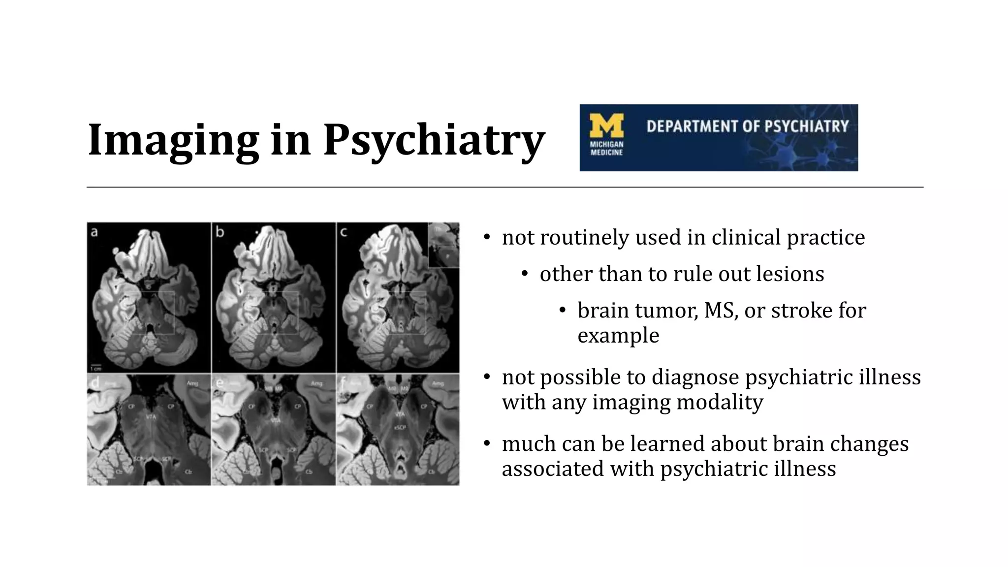 Imaging in Psychiatry
• not routinely used in clinical practice
• other than to rule out lesions
• brain tumor, MS, or stroke for
example
• not possible to diagnose psychiatric illness
with any imaging modality
• much can be learned about brain changes
associated with psychiatric illness
 