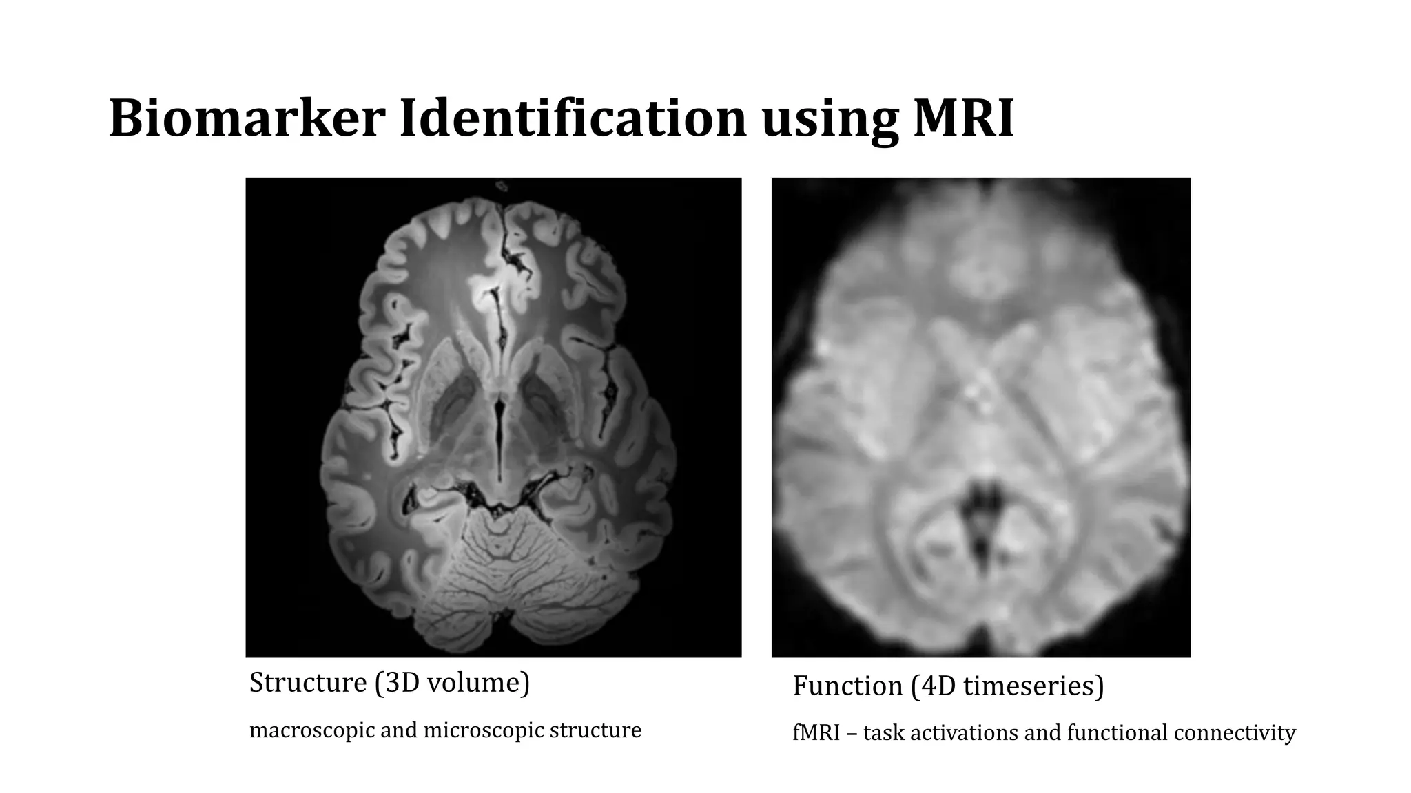 Biomarker Identification using MRI
Structure (3D volume)
macroscopic and microscopic structure
Function (4D timeseries)
fMRI – task activations and functional connectivity
 