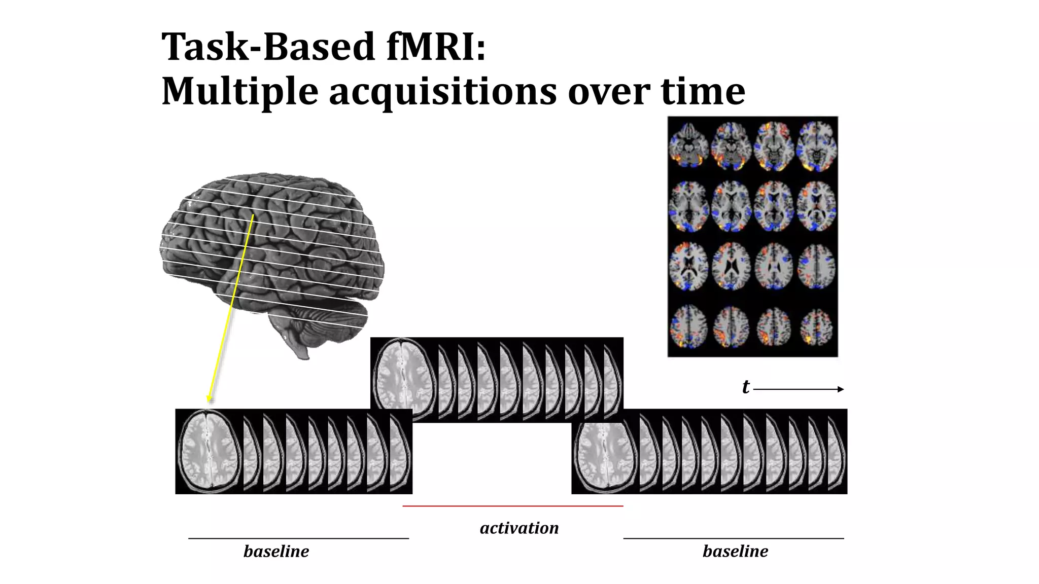 Task-Based fMRI:
Multiple acquisitions over time
t
baseline
activation
baseline
 
