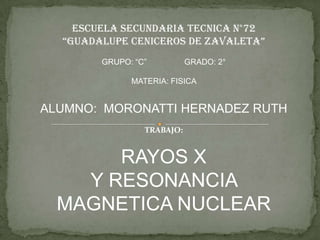 ESCUELA SECUNDARIA TECNICA N°72
  “GUADALUPE CENICEROS DE ZAVALETA”
        GRUPO: “C”          GRADO: 2°

              MATERIA: FISICA


ALUMNO: MORONATTI HERNADEZ RUTH
                 TRABAJO:


       RAYOS X
    Y RESONANCIA
  MAGNETICA NUCLEAR
 