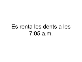 Es renta les dents a les
7:05 a.m.

 