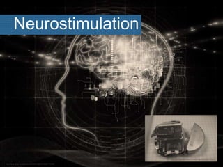 Neurostimulation
http://www.flickr.com/photos/90958025@N03/8384110298/
http://www.flickr.com/photos/27388680@N05/5226737941/
 