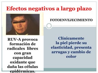 Efectos negativos a largo plazoFOTOENVEJECIMIENTOClínicamentela piel pierde su elasticidad, presenta arrugas y cambio de colorRUV-A provoca formación de radicales  libres con gran capacidad oxidante que daña las células epidérmicas.
