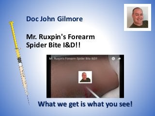 Mr. Ruxpin's Forearm
Spider Bite I&D!!
What we get is what you see!
Doc John Gilmore
 
