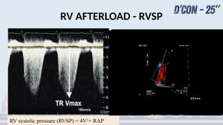 RV Assessment Shanmugam new 2.pptxbnkkkdjjjd | PPTX