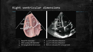Right ventricular dimensions
1. Basal RV diameter
2. Mid cavitary RV diameter
3. RV longitudinal dimension
 4.2 cm indicates dilatation
 3.5 cm indicates dilatation
 8.6 cm indicates RV enlargement
 