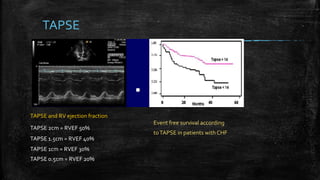 TAPSE
TAPSE and RV ejection fraction
TAPSE 2cm = RVEF 50%
TAPSE 1.5cm = RVEF 40%
TAPSE 1cm = RVEF 30%
TAPSE 0.5cm = RVEF 20%
Event free survival according
toTAPSE in patients with CHF
 
