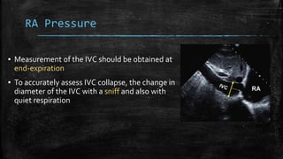 RA Pressure
▪ Measurement of the IVC should be obtained at
end-expiration
▪ To accurately assess IVC collapse, the change in
diameter of the IVC with a sniff and also with
quiet respiration
 