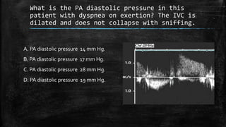 What is the PA diastolic pressure in this
patient with dyspnea on exertion? The IVC is
dilated and does not collapse with sniffing.
A. PA diastolic pressure 14 mm Hg.
B. PA diastolic pressure 17 mm Hg.
C. PA diastolic pressure 28 mm Hg.
D. PA diastolic pressure 19 mm Hg.
 