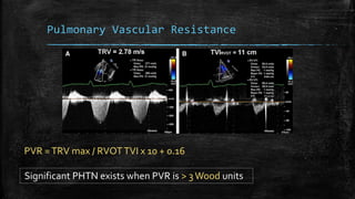 Pulmonary Vascular Resistance
PVR =TRV max / RVOTTVI x 10 + 0.16
Significant PHTN exists when PVR is > 3 Wood units
 