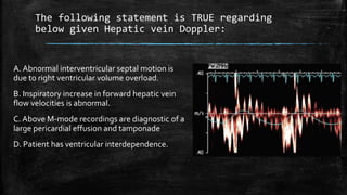 The following statement is TRUE regarding
below given Hepatic vein Doppler:
A. Abnormal interventricular septal motion is
due to right ventricular volume overload.
B. Inspiratory increase in forward hepatic vein
flow velocities is abnormal.
C. Above M-mode recordings are diagnostic of a
large pericardial effusion and tamponade
D. Patient has ventricular interdependence.
 