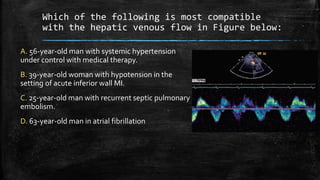Which of the following is most compatible
with the hepatic venous flow in Figure below:
A. 56-year-old man with systemic hypertension
under control with medical therapy.
B. 39-year-old woman with hypotension in the
setting of acute inferior wall MI.
C. 25-year-old man with recurrent septic pulmonary
embolism.
D. 63-year-old man in atrial fibrillation
 
