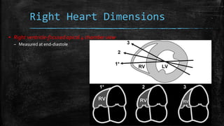 Right ventricular dimensions
1. Basal RV diameter
2. Mid cavitary RV diameter
3. RV longitudinal dimension
 4.2 cm indica...