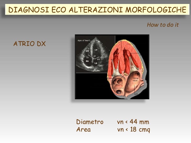 VALUTAZIONE ECOCARDIOGRAFICA del VENTRICOLO DESTRO 1 right ventricl…