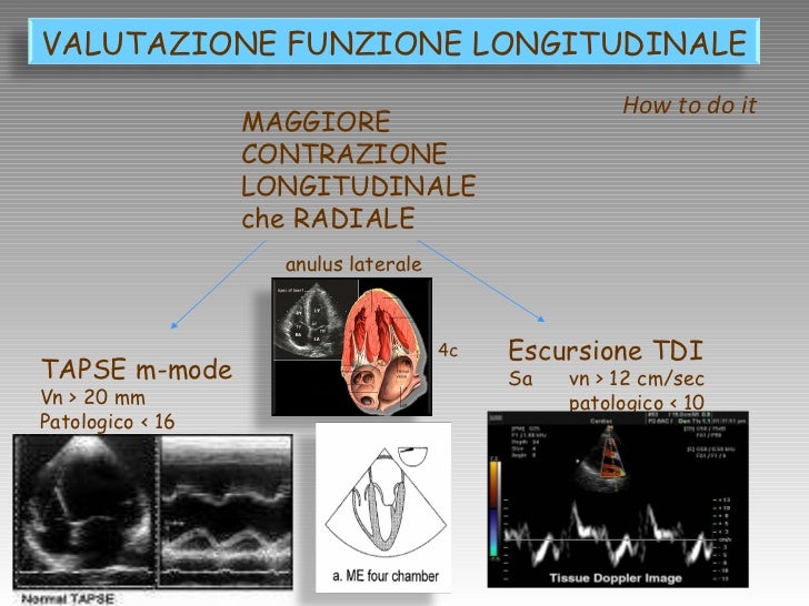 VALUTAZIONE ECOCARDIOGRAFICA del VENTRICOLO DESTRO 1 right ventricl…